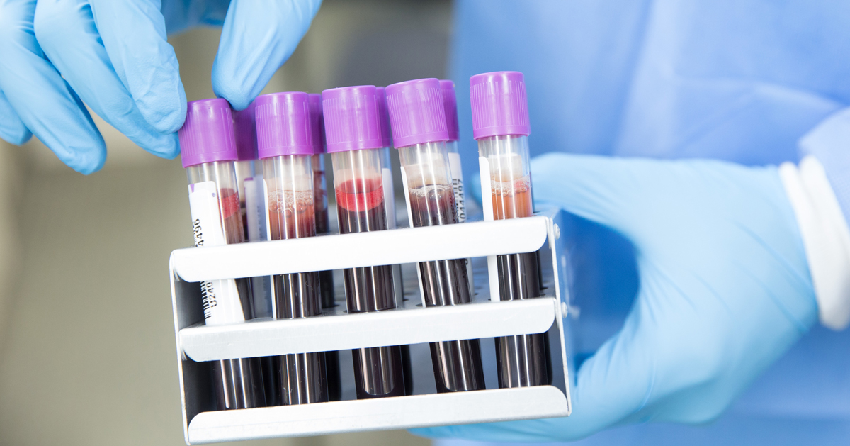 researchers say mass blood tests could help combat coronavirus pandemic