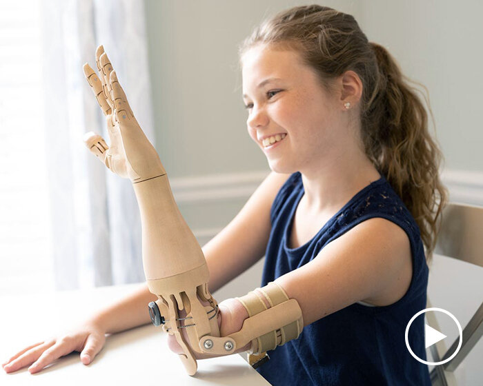 TrueLimb is an affordable prosthetic that uses 3D scanning for a perfect fit