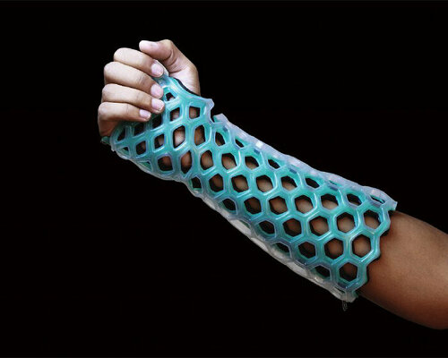 washable and breathable 'flexiOH' orthopedic cast is removed with a zipper