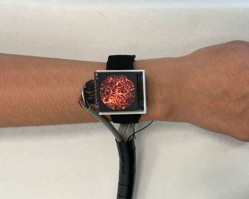 high tech watch takes photos of blood vessels real-time to monitor heart rate anywhere